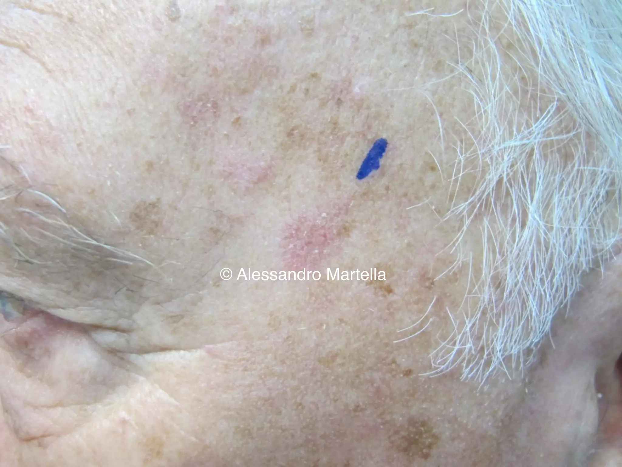 © Alessandro Martella
 