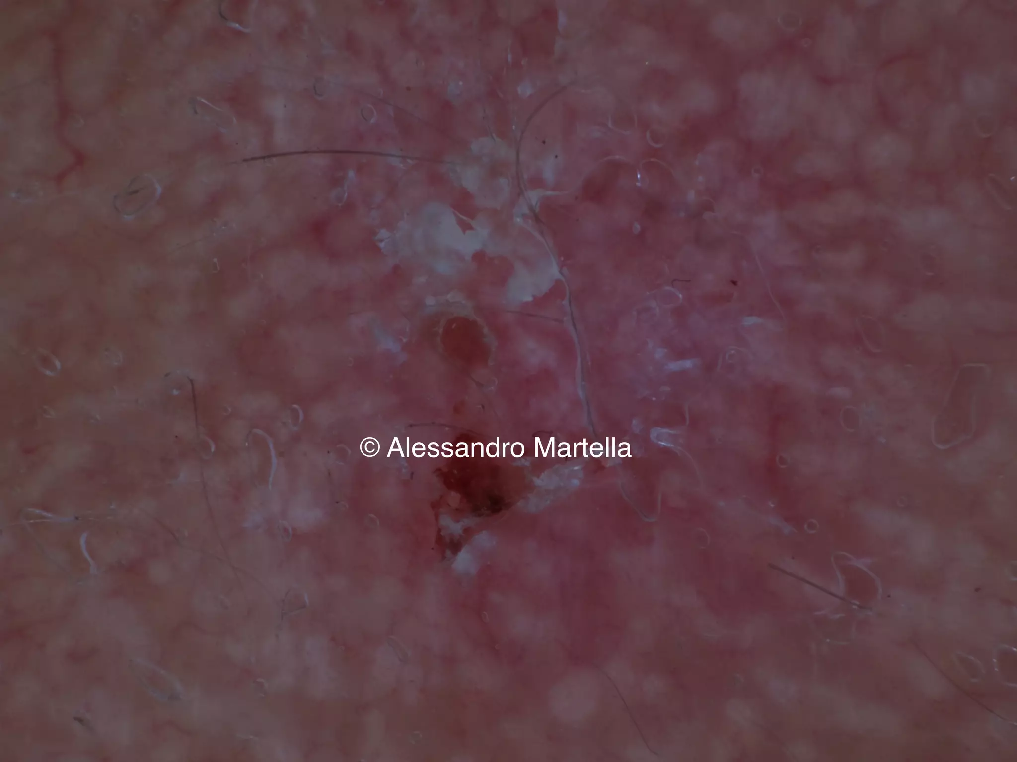 © Alessandro Martella
 