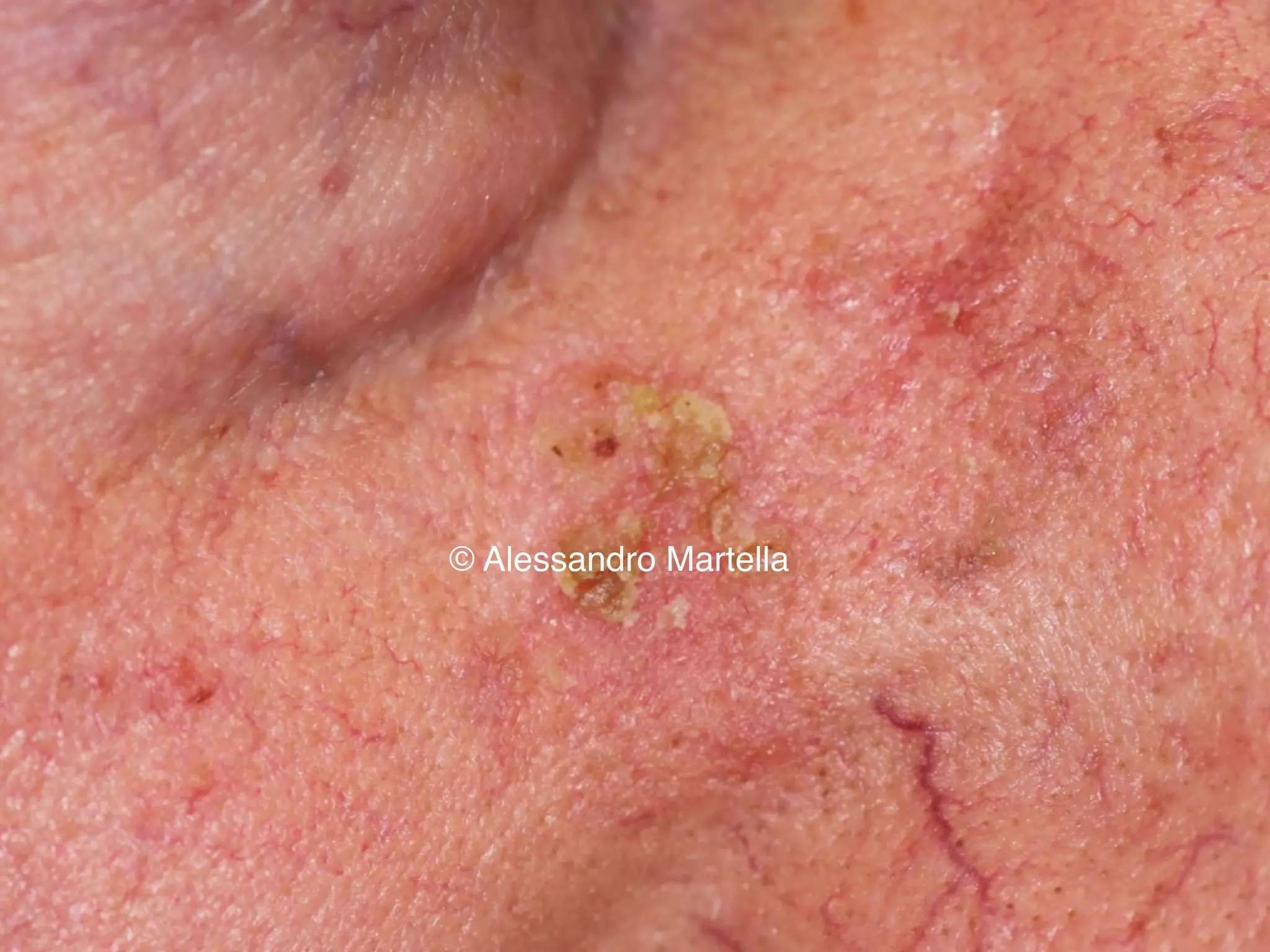 © Alessandro Martella
 