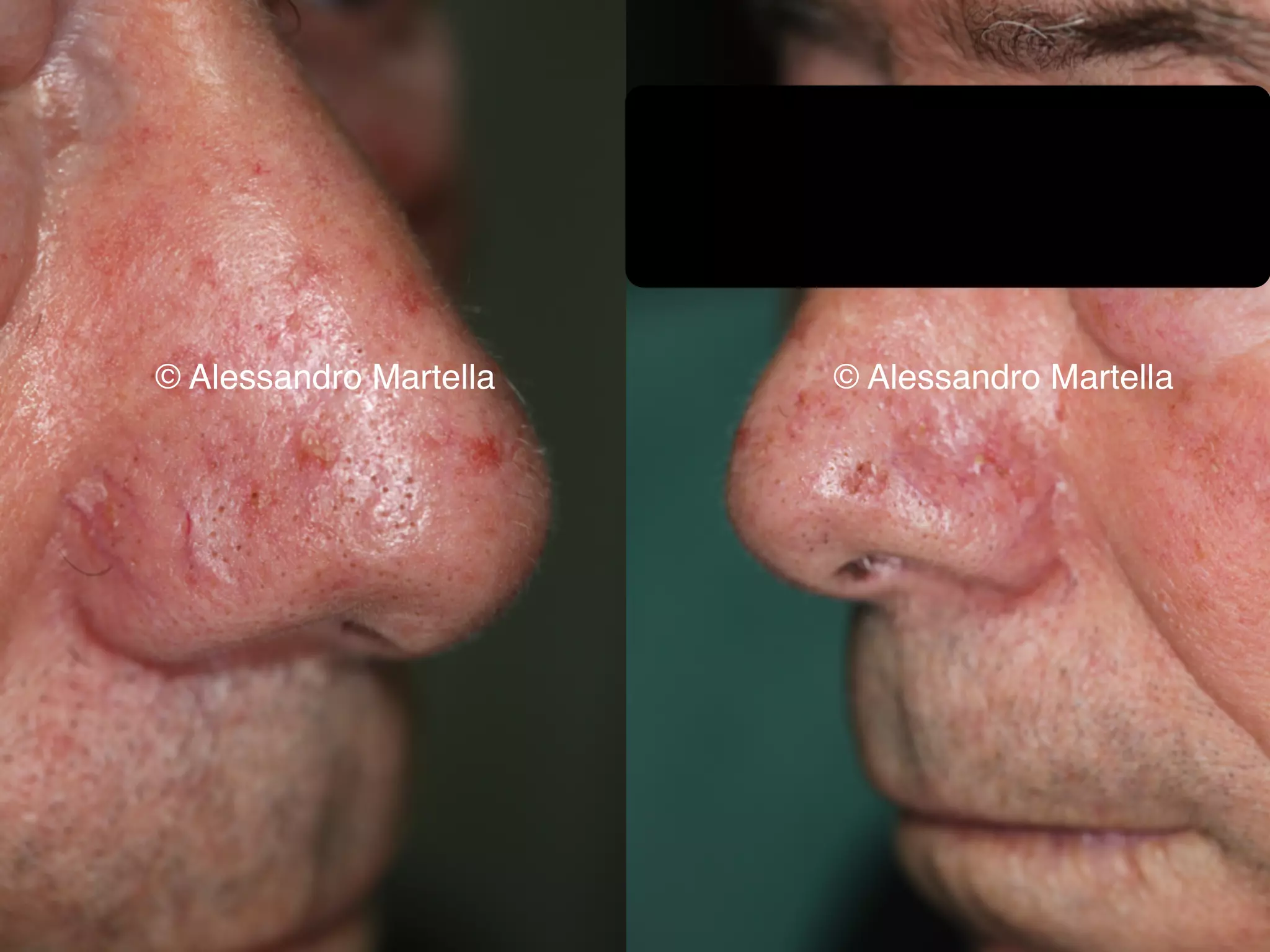 © Alessandro Martella © Alessandro Martella
 