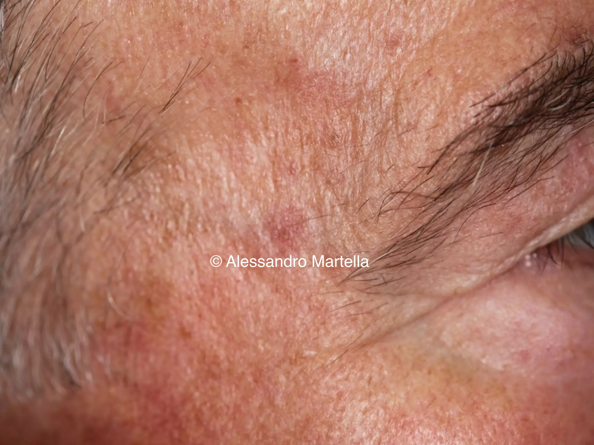 © Alessandro Martella
 