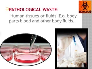 PATHOLOGICAL WASTE:
Human tissues or fluids. E.g. body
parts blood and other body fluids.
 
