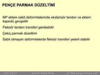 PENÇE PARMAK DÜZELTİMİ


MP eklem sabit deformitelerinde ekstensör tendon ve eklem
kapsülü gevşetilir
Fleksör tendon transferi gerekebilir
Çekiç parmak düzeltimi
Sabit olmayan deformitelerde fleksör transferi yeterli olabilir




Tahir ÖĞÜT           KAVOVARUS AYAK           20. Milli Kongre Ankara 2007
 