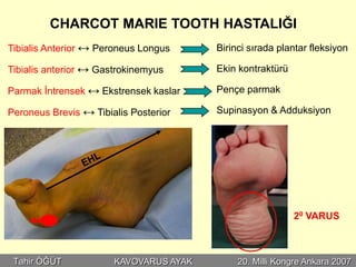 CHARCOT MARIE TOOTH HASTALIĞI
Tibialis Anterior ↔ Peroneus Longus     Birinci sırada plantar fleksiyon

Tibialis anterior ↔ Gastrokinemyus      Ekin kontraktürü

Parmak İntrensek ↔ Ekstrensek kaslar    Pençe parmak

Peroneus Brevis ↔ Tibialis Posterior    Supinasyon & Adduksiyon




                                                           20 VARUS



 Tahir ÖĞÜT            KAVOVARUS AYAK        20. Milli Kongre Ankara 2007
 