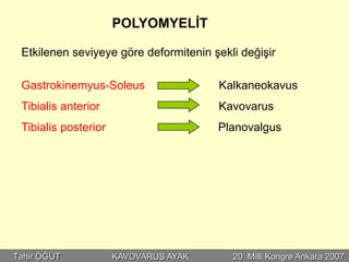 POLYOMYELİT

 Etkilenen seviyeye göre deformitenin şekli değişir

 Gastrokinemyus-Soleus                 Kalkaneokavus
 Tibialis anterior                     Kavovarus
 Tibialis posterior                    Planovalgus




Tahir ÖĞÜT            KAVOVARUS AYAK      20. Milli Kongre Ankara 2007
 