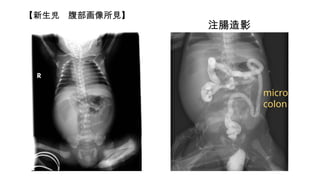  Ҋ
עcӰ
micro
colon
 