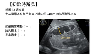 \rҊ
 33 L 0 
ʮָcTȤСc˾ 24mm ΒҊ
cӣ
̥ˮ
ˮ^ࣨ
24mm
 