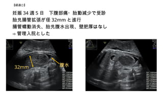 U^١
 34 L 5  ¸ʹ?̥Ӝp٤\
̥cܒ 32mm M
cʧ̥ˮFڷʺϤʤ
? ԺȤ
ˮ
32mm
 