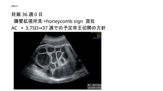 U^ۡ
 36 L
cܒҊ +honeycomb sign 
AC  3.7SD 37
? LǤ趨_η
 