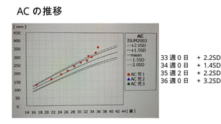 AC 
33 L 0   2.2SD
34 L 0   1.4SD
35 L 2   2.2SD
36 L 0   3.2SD
 