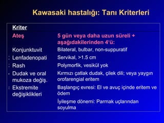 Kawasaki hastalığı: Tanı Kriterleri  Kriter Ateş 5 gün veya daha uzun süreli + aşağıdakilerinden 4‘ü: 1 Konjunktuvit  Bilateral, bulbar, non-suppuratif 2 Lenfadenopati Servikal, >1.5 cm 3 Rash Polymorfik, vesikül yok 4 Dudak ve oral mukoza değiş. Kırmızı çatlak dudak, çilek dili; veya yaygın orofarengial eritem 5 Ekstremite değişiklikleri Başlangıç evresi: El ve avuç içinde eritem ve ödem İyileşme dönemi: Parmak uçlarından soyulma 