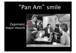 Pan Am smile

  Zygomatic
major muscle
 