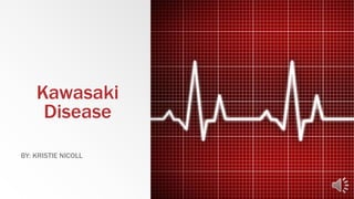 Kawasaki
Disease
BY: KRISTIE NICOLL
 