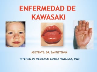 INTERNO DE MEDICINA: GOMEZ HINOJOSA, Paúl
ASISTENTE: DR. SANTISTEBAN
 
