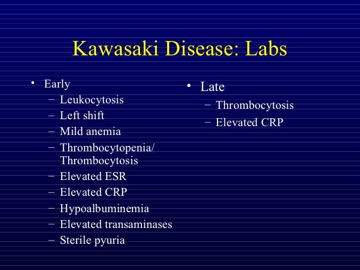 pediatrics.Kawasaki disease.(dr.khalid)