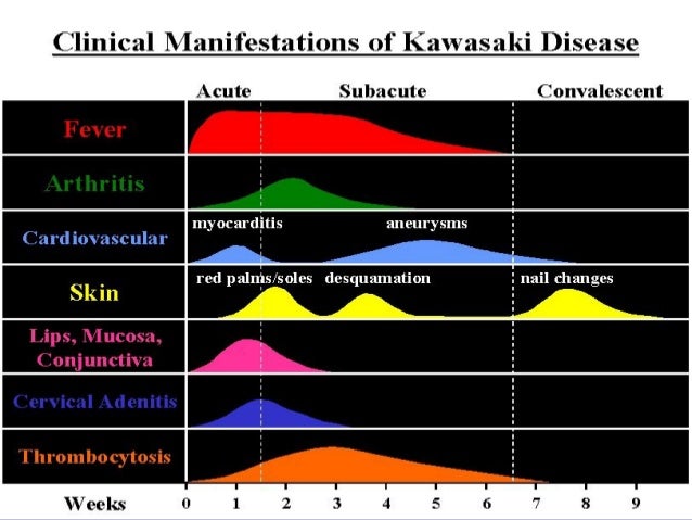 Immunization After Kawasaki Disease Immunization After Kawasaki Disease