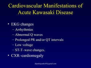 Cardiovascular Manifestations of
Acute Kawasaki Disease
• EKG changes
– ArrhythmiasArrhythmias
– Abnormal Q wavesAbnormal ...