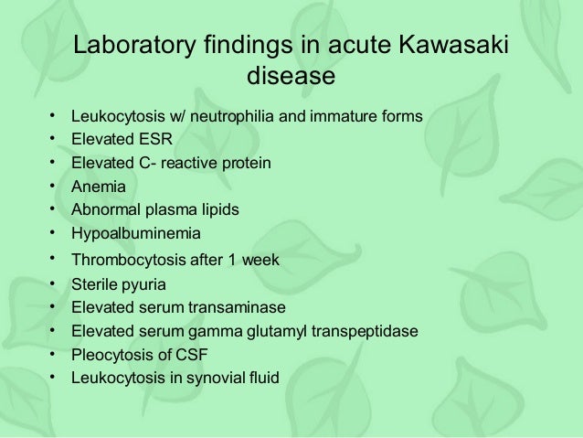 After Treatment Of Kawasaki Disease After Treatment Of Kawasaki Disease
