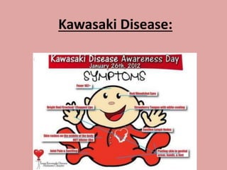 Kawasaki Disease:
 