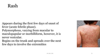 Morbilliform Ramaculopapular Rssh Kawasaki Disease and Henoch-Schonlein purpura in Children.pptx
