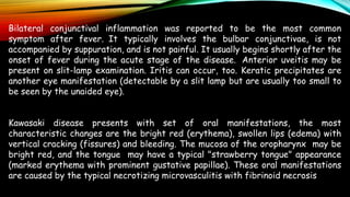 Bilateral conjunctival inflammation was reported to be the most common
symptom after fever. It typically involves the bulbar conjunctivae, is not
accompanied by suppuration, and is not painful. It usually begins shortly after the
onset of fever during the acute stage of the disease. Anterior uveitis may be
present on slit-lamp examination. Iritis can occur, too. Keratic precipitates are
another eye manifestation (detectable by a slit lamp but are usually too small to
be seen by the unaided eye).
Kawasaki disease presents with set of oral manifestations, the most
characteristic changes are the bright red (erythema), swollen lips (edema) with
vertical cracking (fissures) and bleeding. The mucosa of the oropharynx may be
bright red, and the tongue may have a typical "strawberry tongue" appearance
(marked erythema with prominent gustative papillae). These oral manifestations
are caused by the typical necrotizing microvasculitis with fibrinoid necrosis
 