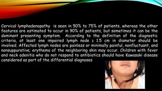 Cervical lymphadenopathy is seen in 50% to 75% of patients, whereas the other
features are estimated to occur in 90% of patients, but sometimes it can be the
dominant presenting symptom. According to the definition of the diagnostic
criteria, at least one impaired lymph node ≥ 1.5 cm in diameter should be
involved. Affected lymph nodes are painless or minimally painful, nonfluctuant, and
nonsuppurative; erythema of the neighboring skin may occur. Children with fever
and neck adenitis who do not respond to antibiotics should have Kawasaki disease
considered as part of the differential diagnoses
 