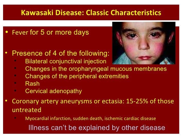 kawasaki disease ppt Kawasaki disease (kd) 2.