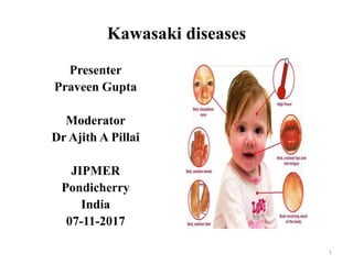 Kawasaki diseases
Presenter
Praveen Gupta
Moderator
Dr Ajith A Pillai
JIPMER
Pondicherry
India
07-11-2017
1
 