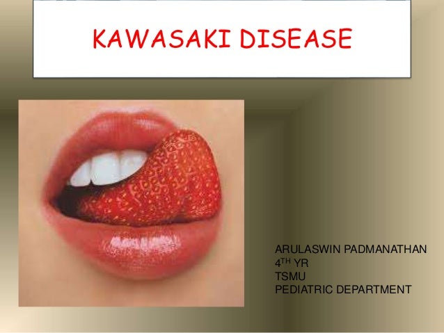 Kawasaki Disease Is Characterized By Kawasaki Disease Is Characterized By