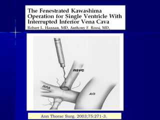 Ann Thorac Surg. 2003;75:271-3.
 
