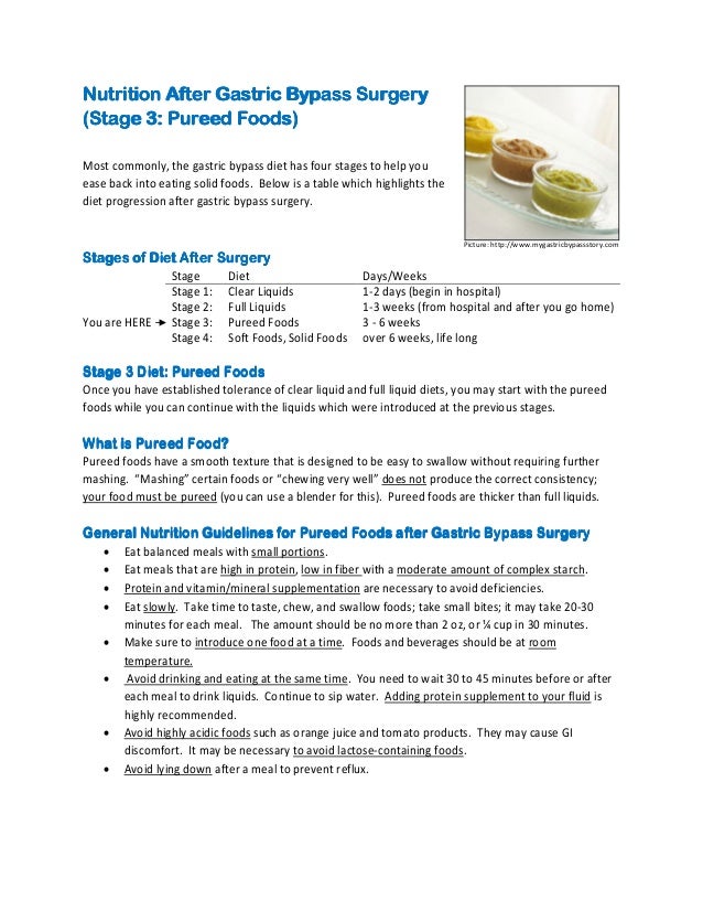 2 Week Liquid Diet Bariatric Surgery