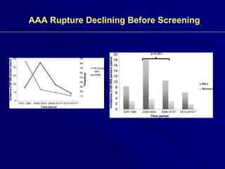 Abdominal Aortic and Thoracic Aneurysms | PPT