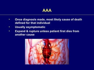Abdominal Aortic and Thoracic Aneurysms | PPT