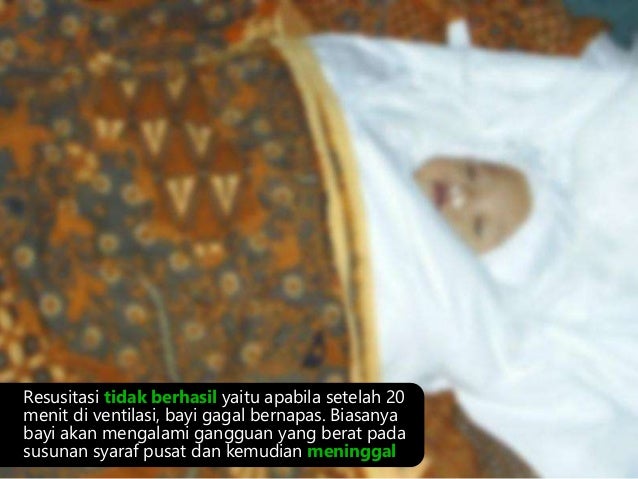 Kb 1 resusitasi pada bayi baru lahir