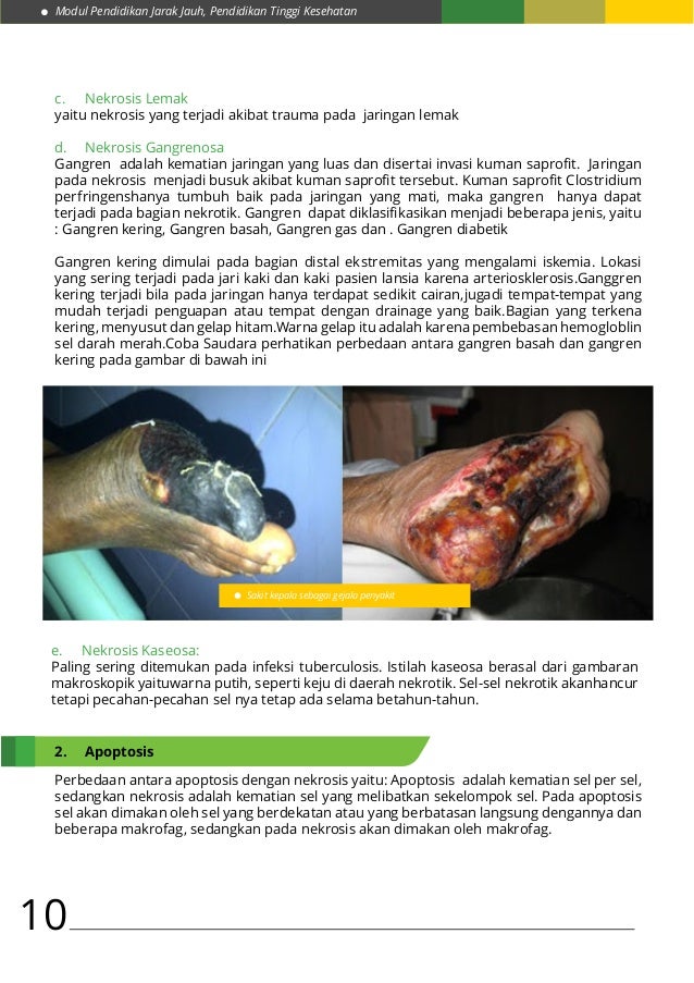 Tahap kematian jaringan dan nekrosis sel