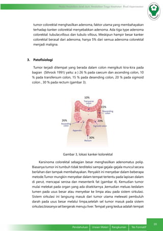 10
Modul Pendidikan Jarak Jauh, Pendidikan Tinggi Kesehatan Prodi Keperawatan
Pendahuluan	 Uraian Materi	 Rangkuman	 Tes Formatif
tumor colorektal menghasilkan adenoma, faktor utama yang membahayakan
terhadap kanker colorektal menyebabkan adenoma. Ada tiga type adenoma
colorektal: tubular,villous dan tubulo villous, Meskipun hampir besar kanker
colorektal berasal dari adenoma, hanya 5% dari semua adenoma colorektal
menjadi maligna.
3.	 Patofisiologi
Tumor terjadi ditempat yang berada dalam colon mengikuti kira-kira pada
bagian (Sthrock 1991) yaitu: a ) 26 % pada caecum dan ascending colon, 10
% pada transfersum colon, 15 % pada desending colon, 20 % pada sigmoid
colon , 30 % pada rectum (gambar 3).
Gambar 3, lokasi kanker kolorektal
Karsinoma colorektal sebagian besar menghasilkan adenomatus polip.
Biasanya tumor ini tumbuh tidak terditeksi sampai gejala-gejala muncul secara
berlahan dan tampak membahayakan. Penyakit ini menyebar dalam beberapa
metode.Tumor mungkin menyebar dalam tempat tertentu pada lapisan dalam
di perut, mencapai serosa dan mesenterik fat (gambar 4). Kemudian tumor
mulai melekat pada organ yang ada disekitarnya ,kemudian meluas kedalam
lumen pada usus besar atau menyebar ke limpa atau pada sistem sirkulasi.
Sistem sirkulasi ini langsung masuk dari tumor utama melewati pembuluh
darah pada usus besar melalui limpa,setelah sel tumor masuk pada sistem
sirkulasi,biasanya sel bergerak menuju liver. Tempat yang kedua adalah tempat
10%
20%26%
30%
15%
 