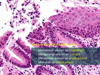 Bentuk-Bentuk Adaptasi Sel:
Menambah ukuran sel (hipertrofi)
Mengurangi ukuran sel (atropi)
Menambah jumlah sel (hyperplasia)
Merubah sel (meta plasia)
 