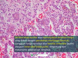 Sel bisa tetap normal atau menunjukkan kelainan fungsi
yang diikuti dengan perubahan morfologis (bentuk).
Gangguan fungsi tersebut bisa bersifat reversible (pulih)
ataupun ireversibel (tidak pulih) tergantung dari
mekanisme adaptasi sel tersebut.
 