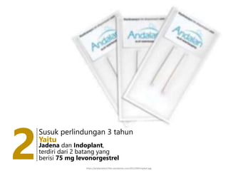 2
-------------------
Susuk perlindungan 3 tahun
Jadena dan Indoplant,
terdiri dari 2 batang yang
berisi 75 mg levonorgestrel
Yaitu
https://prytipratiwi3.files.wordpress.com/2012/09/implant.jpg
 