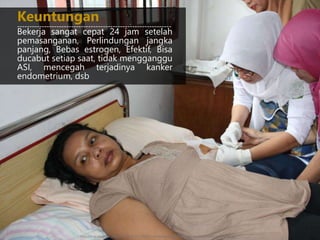 Bekerja sangat cepat 24 jam setelah
pemasanganan, Perlindungan jangka
panjang, Bebas estrogen, Efektif, Bisa
ducabut setiap saat, tidak mengganggu
ASI, mencegah terjadinya kanker
endometrium, dsb
Keuntungan
---------------------------------------------------------------
http://4.bp.blogspot.com/-dCdUtjzK-zk/ToPeRFj-UPI/AAAAAAAAABw/9s_9Q5Hm4KQ/s1600/IMG_2038.jpg
 