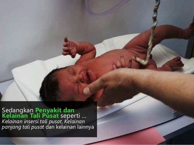 KB 2 Komplikasi Kehamilan