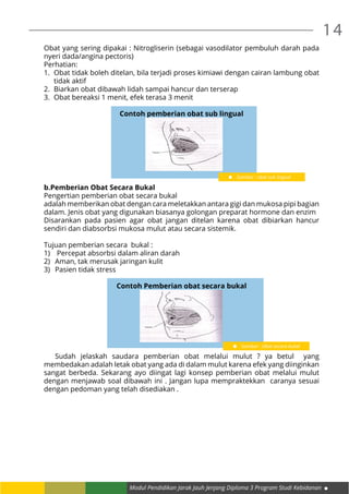 14
Modul Pendidikan Jarak Jauh Jenjang Diploma 3 Program Studi Kebidanan
Obat yang sering dipakai : Nitrogliserin (sebagai vasodilator pembuluh darah pada
nyeri dada/angina pectoris)
Perhatian:
1.	 Obat tidak boleh ditelan, bila terjadi proses kimiawi dengan cairan lambung obat
tidak aktif
2.	 Biarkan obat dibawah lidah sampai hancur dan terserap
3.	 Obat bereaksi 1 menit, efek terasa 3 menit
Contoh pemberian obat sub lingual
b.Pemberian Obat Secara Bukal
Pengertian pemberian obat secara bukal
adalah memberikan obat dengan cara meletakkan antara gigi dan mukosa pipi bagian
dalam. Jenis obat yang digunakan biasanya golongan preparat hormone dan enzim
Disarankan pada pasien agar obat jangan ditelan karena obat dibiarkan hancur
sendiri dan diabsorbsi mukosa mulut atau secara sistemik.
Tujuan pemberian secara bukal :
1)	 Percepat absorbsi dalam aliran darah
2)	 Aman, tak merusak jaringan kulit
3)	 Pasien tidak stress
Contoh Pemberian obat secara bukal
	 Sudah jelaskah saudara pemberian obat melalui mulut ? ya betul yang
membedakan adalah letak obat yang ada di dalam mulut karena efek yang diinginkan
sangat berbeda. Sekarang ayo diingat lagi konsep pemberian obat melalui mulut
dengan menjawab soal dibawah ini . Jangan lupa mempraktekkan caranya sesuai
dengan pedoman yang telah disediakan .
Gambar : obat sub lingual
Gambar : Obat secara bukal
 