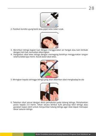 28
Modul Pendidikan Jarak Jauh Jenjang Diploma 3 Program Studi Kebidanan
2. Pastikan kondisi ujung botol atau pipet tetes tidak rusak.
3.	 Bersihkan telinga bagian luar dengan menggunakan air hangat atau kain lembab
dengan hati-hati, kemudian dikeringkan
4.	 Hangatkan obat tetes telinga dengan memegang botolnya menggunakan tangan
selama beberapa menit. Kocok botol obat tetes.
5. Miringkan kepala sehingga telinga yang akan diberikan obat menghadap ke ata
6. Teteskan obat sesuai dengan dosis pemakaian pada lubang telinga. Pertahankan
posisi kepala 2-3 menit. Tekan secara lembut kulit penutup kecil telinga atau
gunakan kapas steril untuk menyumbat lubang telinga agar obat dapat mencapai
dasar saluran telinga.
 