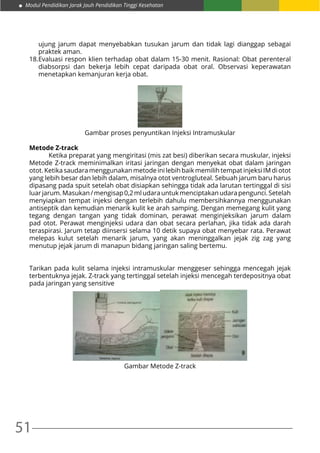51
Modul Pendidikan Jarak Jauh Pendidikan Tinggi Kesehatan
ujung jarum dapat menyebabkan tusukan jarum dan tidak lagi dianggap sebagai
praktek aman.
18.	Evaluasi respon klien terhadap obat dalam 15-30 menit. Rasional: Obat perenteral
diabsorpsi dan bekerja lebih cepat daripada obat oral. Observasi keperawatan
menetapkan kemanjuran kerja obat.
Gambar proses penyuntikan Injeksi Intramuskular
Metode Z-track
	 Ketika preparat yang mengiritasi (mis zat besi) diberikan secara muskular, injeksi
Metode Z-track meminimalkan iritasi jaringan dengan menyekat obat dalam jaringan
otot. Ketika saudara menggunakan metode ini lebih baik memilih tempat injeksi IM di otot
yang lebih besar dan lebih dalam, misalnya otot ventrogluteal. Sebuah jarum baru harus
dipasang pada spuit setelah obat disiapkan sehingga tidak ada larutan tertinggal di sisi
luarjarum.Masukan/mengisap0,2mludarauntukmenciptakanudarapengunci.Setelah
menyiapkan tempat injeksi dengan terlebih dahulu membersihkannya menggunakan
antiseptik dan kemudian menarik kulit ke arah samping. Dengan memegang kulit yang
tegang dengan tangan yang tidak dominan, perawat menginjeksikan jarum dalam
pad otot. Perawat menginjeksi udara dan obat secara perlahan, jika tidak ada darah
teraspirasi. Jarum tetap diinsersi selama 10 detik supaya obat menyebar rata. Perawat
melepas kulut setelah menarik jarum, yang akan meninggalkan jejak zig zag yang
menutup jejak jarum di manapun bidang jaringan saling bertemu.
Tarikan pada kulit selama injeksi intramuskular menggeser sehingga mencegah jejak
terbentuknya jejak. Z-track yang tertinggal setelah injeksi mencegah terdepositnya obat
pada jaringan yang sensitive
Gambar Metode Z-track
 