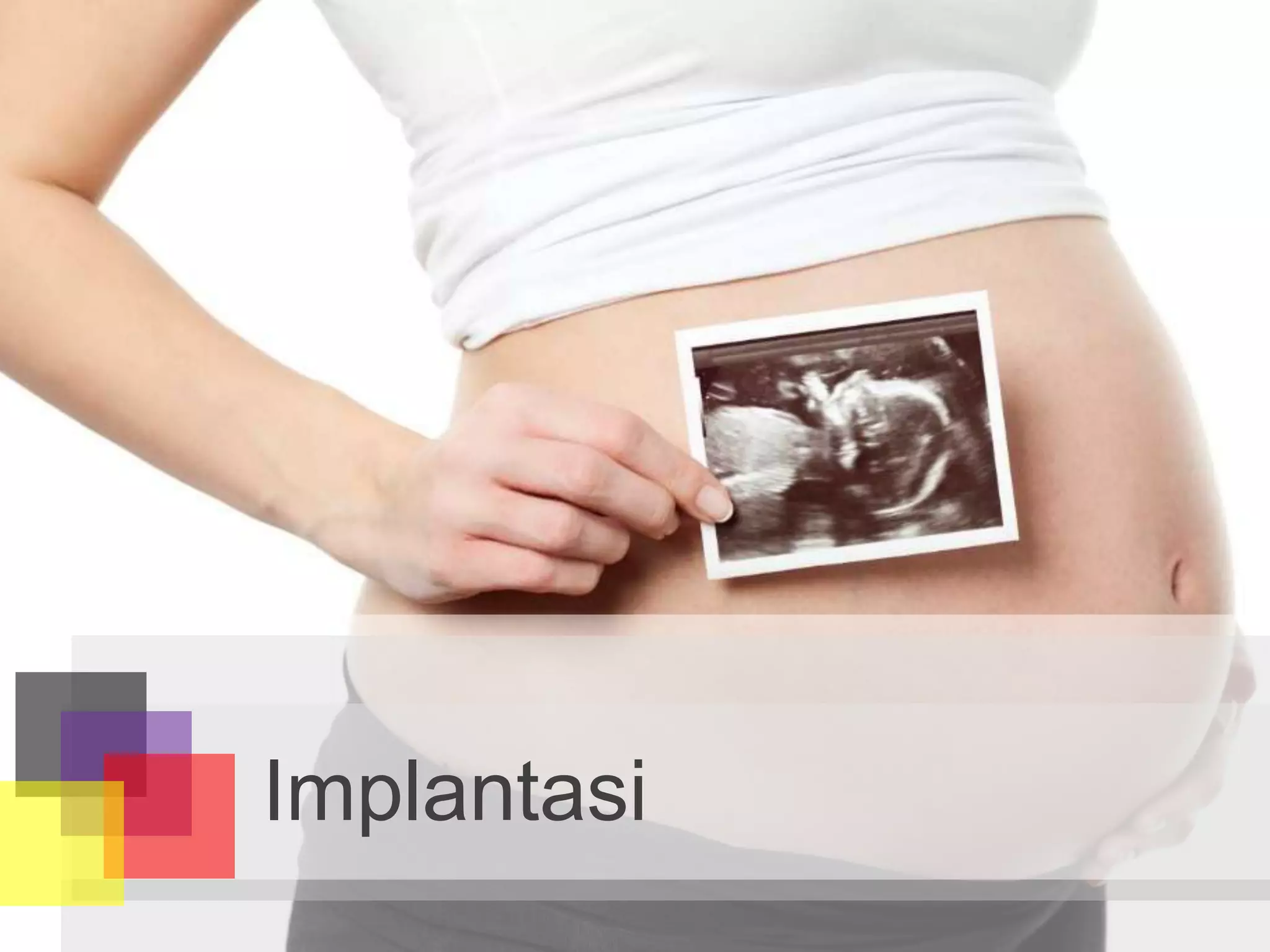 Implantasi
 