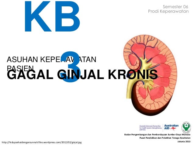 63 Gambar Pasien Gagal Ginjal 63 Gambar Pasien Gagal Ginjal