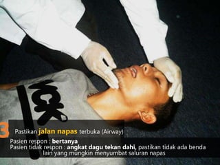 Pasien respon : bertanya
Pasien tidak respon : angkat dagu tekan dahi, pastikan tidak ada benda
lain yang mungkin menyumbat saluran napas
Pastikan jalan napas terbuka (Airway)
3
 