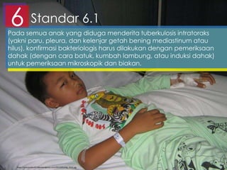 Standar 6.16Pada semua anak yang diduga menderita tuberkulosis intratoraks
(yakni paru, pleura, dan kelenjar getah bening mediastinum atau
hilus), konfirmasi bakteriologis harus dilakukan dengan pemeriksaan
dahak (dengan cara batuk, kumbah lambung, atau induksi dahak)
untuk pemeriksaan mikroskopik dan biakan.
https://antoniusbudi9.files.wordpress.com/2013/05/img_1632.jpg
 