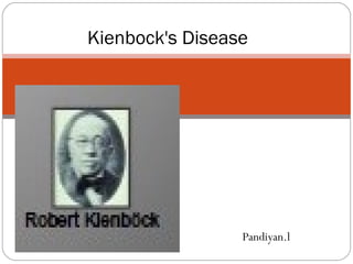 Pandiyan.l
Kienbock's Disease
 