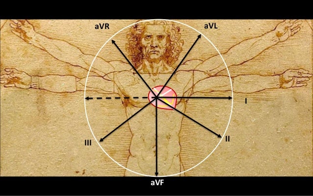 King Bay Ecg Stemi King Bay Ecg Stemi